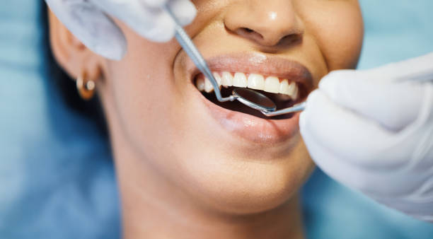 Best Emergency Treatment for Dental Infections or Abscesses in Saluda, SC