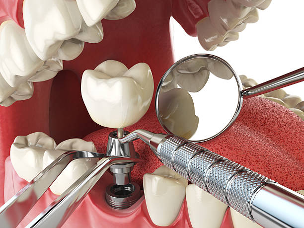 Best Emergency Gum Treatment in Saluda, SC